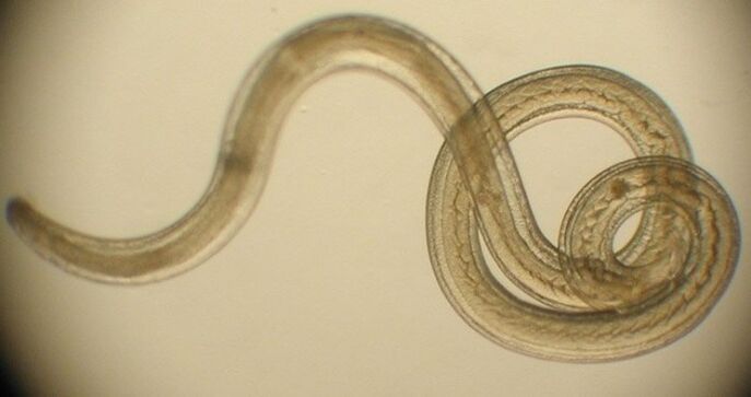parasitärer Wurm des menschlichen Körpers