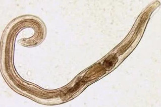 menschliche Parasiten Madenwürmer